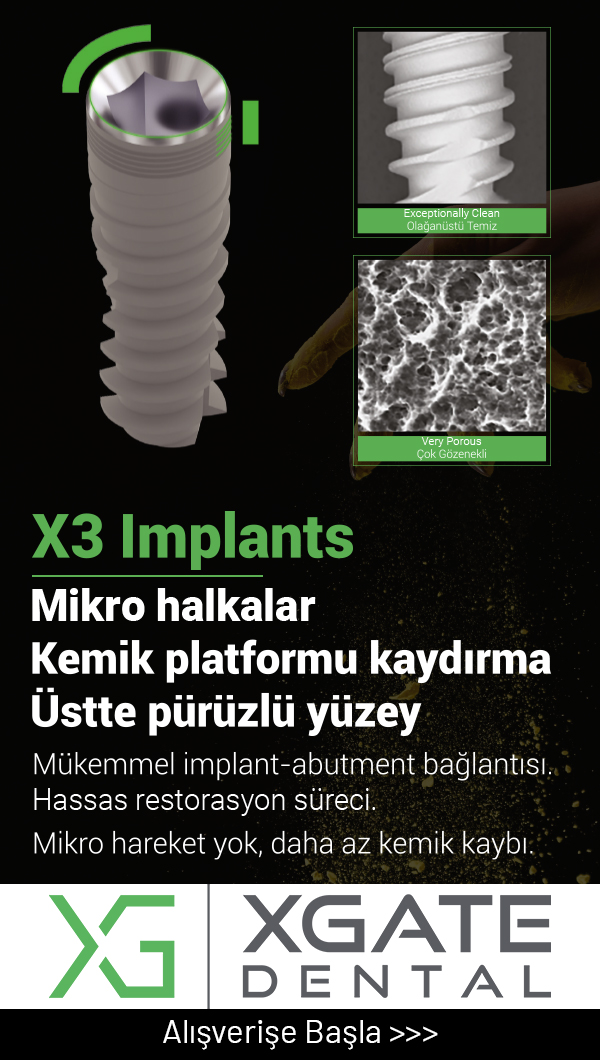 x-gate dental implant