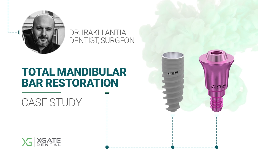 Total Mandibular Bar Restorasyonu: Ultra Düşük Profilli MUA V-Tipi ile Vidalı Retansiyon