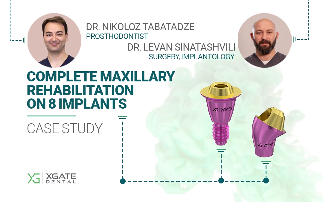 XGATE Dental D-Tipi ve V-Tipi Çok Üniteli Abutmentlerin Kombinasyonuyla 8 İmplant Üzerinde Tam Üst Çene Rehabilitasyonu