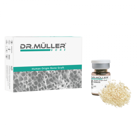 Dr. Müller-İnsan Kaynaklı Kemik Grefti